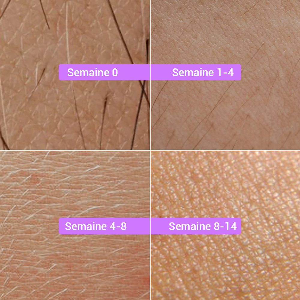 Votre voyage vers Peau sans