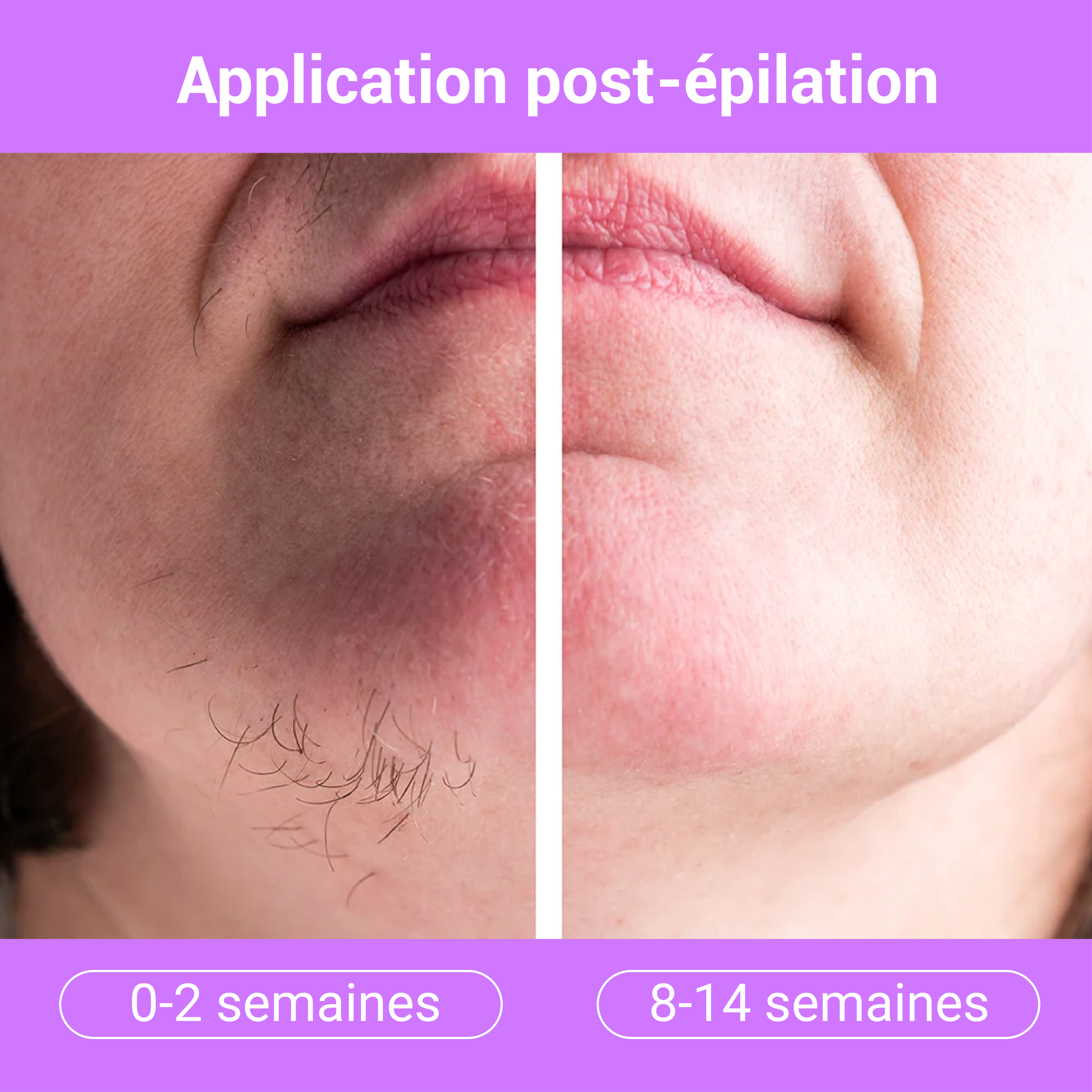 Sérum Lissant Anti-Repousse