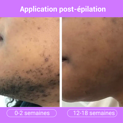 Sérum Lissant Anti-Repousse