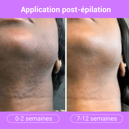 Sérum Lissant Anti-Repousse